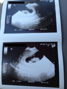 First ultrasound